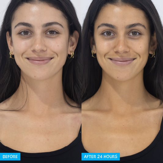 Before and after results using MooGoo Natural Tanning Face Mist, model’s skin shows natural sunless tan with radiant glow after 24 hour
